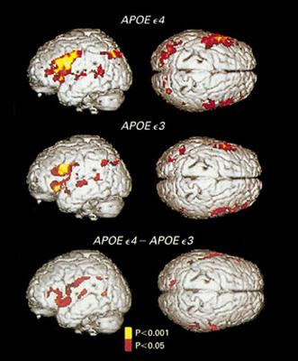 FMRI scans